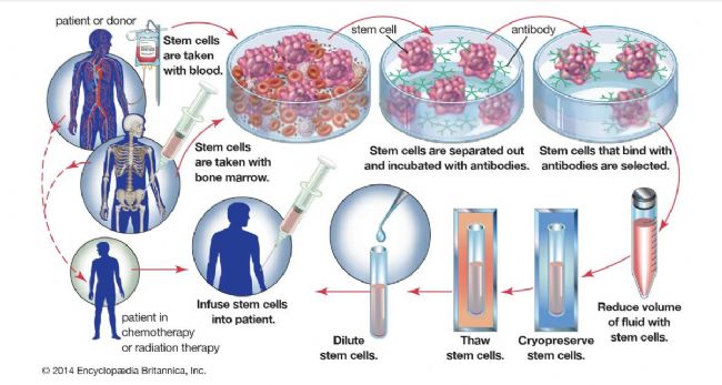 LABCONCO凍干機：冷凍保存技術在冷凍和儲存造血干細胞上的應用